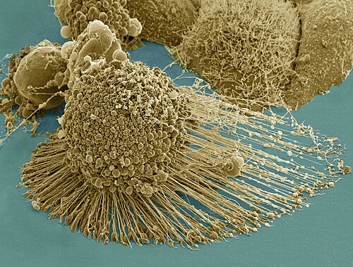 HeLa cells